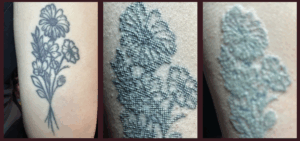 MorphIUs Laser and Longevity Studio Fremantle